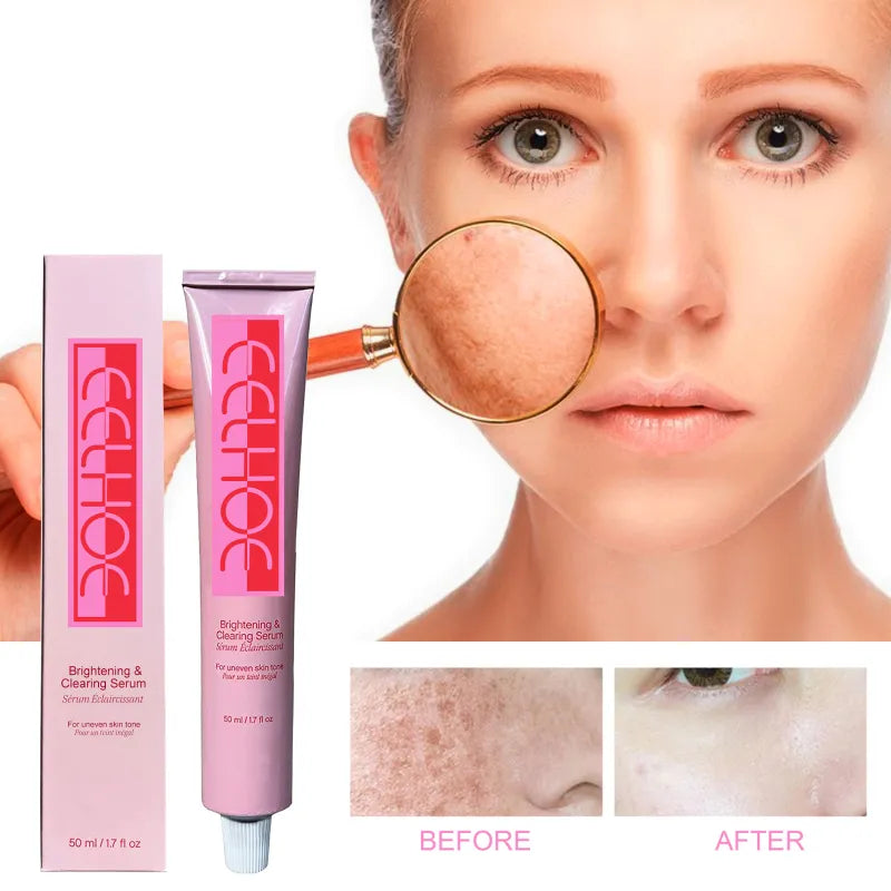 Fade Skin Spots Brightening